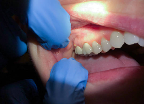 Best Emergency Dentist for Knocked-Out Tooth in Laguna Park, TX